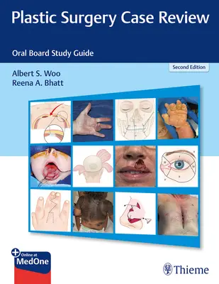 Przegląd przypadków z zakresu chirurgii plastycznej: Oral Board Study Guide - Plastic Surgery Case Review: Oral Board Study Guide