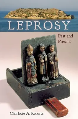 Trąd: przeszłość i teraźniejszość - Leprosy: Past and Present