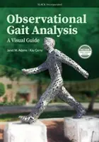 Obserwacyjna analiza chodu: Przewodnik wizualny - Observational Gait Analysis: A Visual Guide