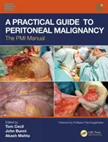 Praktyczny przewodnik po nowotworach otrzewnej: Podręcznik PMI - A Practical Guide to Peritoneal Malignancy: The PMI Manual