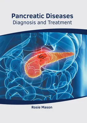 Choroby trzustki: Diagnoza i leczenie - Pancreatic Diseases: Diagnosis and Treatment