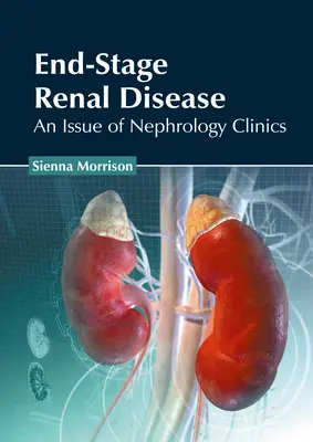 Schyłkowa niewydolność nerek: Wydanie klinik nefrologicznych - End-Stage Renal Disease: An Issue of Nephrology Clinics