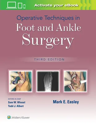 Techniki operacyjne w chirurgii stóp i kostek - Operative Techniques in Foot and Ankle Surgery