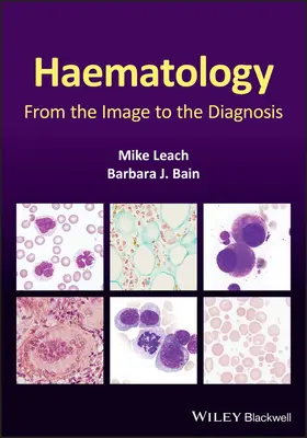 Hematologia: Od obrazu do diagnozy - Haematology: From the Image to the Diagnosis