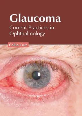 Jaskra: Aktualne praktyki w okulistyce - Glaucoma: Current Practices in Ophthalmology