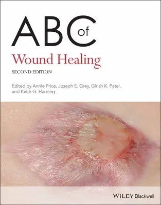 ABC leczenia ran - ABC of Wound Healing