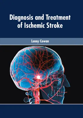 Diagnoza i leczenie udaru niedokrwiennego mózgu - Diagnosis and Treatment of Ischemic Stroke