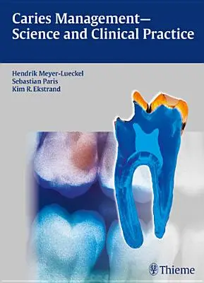 Leczenie próchnicy - nauka i praktyka kliniczna - Caries Management - Science and Clinical Practice
