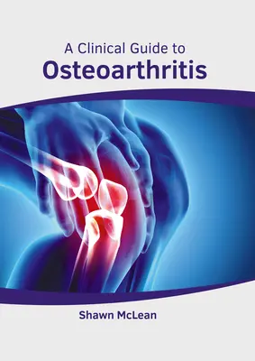 Przewodnik kliniczny po chorobie zwyrodnieniowej stawów - A Clinical Guide to Osteoarthritis