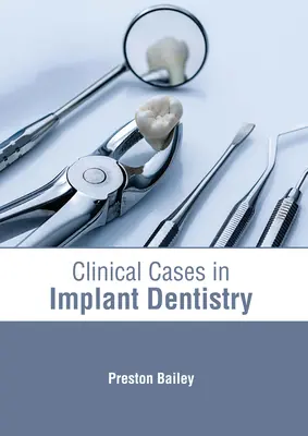 Przypadki kliniczne w stomatologii implantologicznej - Clinical Cases in Implant Dentistry