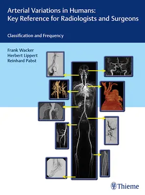 Odmiany tętnic u ludzi: Key Reference for Radiologists and Surgeons: Klasyfikacje i częstotliwość - Arterial Variations in Humans: Key Reference for Radiologists and Surgeons: Classifications and Frequency