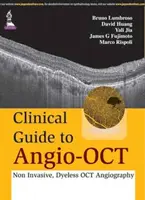 Przewodnik kliniczny po Angio-OCT: nieinwazyjna angiografia OCT bez barwnika - Clinical Guide to Angio-OCT: Non Invasive, Dyeless OCT Angiography