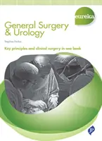 Eureka: Chirurgia ogólna i urologia - Eureka: General Surgery & Urology