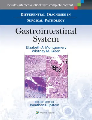 Diagnostyka różnicowa w patologii chirurgicznej: Układ pokarmowy - Differential Diagnoses in Surgical Pathology: Gastrointestinal System