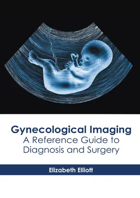 Obrazowanie ginekologiczne: Przewodnik po diagnostyce i chirurgii - Gynecological Imaging: A Reference Guide to Diagnosis and Surgery