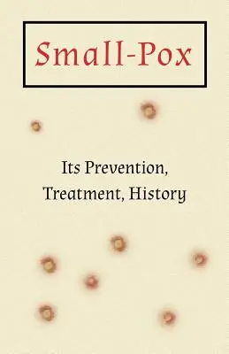 Ospa wietrzna: Zapobieganie, leczenie, historia - Small-Pox: Its Prevention, Treatment, History