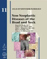 Nienowotworowe choroby głowy i szyi - Non-Neoplastic Diseases of the Head and Neck