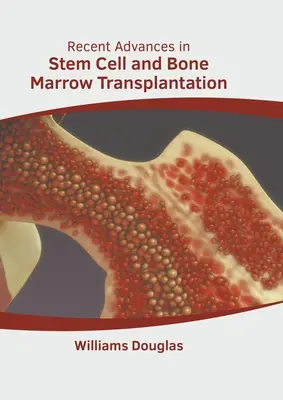 Najnowsze osiągnięcia w transplantacji komórek macierzystych i szpiku kostnego - Recent Advances in Stem Cell and Bone Marrow Transplantation