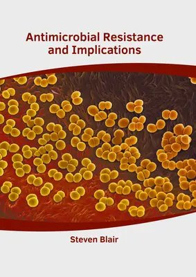 Oporność na środki przeciwdrobnoustrojowe i jej implikacje - Antimicrobial Resistance and Implications