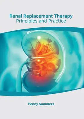 Terapia nerkozastępcza: Zasady i praktyka - Renal Replacement Therapy: Principles and Practice