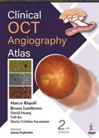 Atlas angiografii klinicznej OCT - Clinical OCT Angiography Atlas