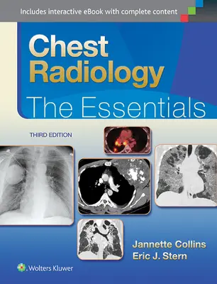 Radiologia klatki piersiowej: Podstawy - Chest Radiology: The Essentials