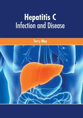 Wirusowe zapalenie wątroby typu C: Infekcja i choroba - Hepatitis C: Infection and Disease