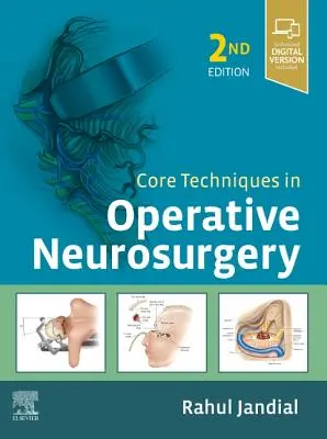 Podstawowe techniki w neurochirurgii operacyjnej - Core Techniques in Operative Neurosurgery