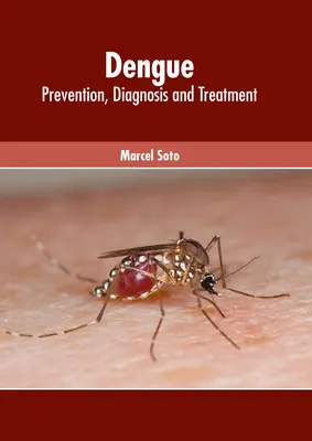 Denga: Zapobieganie, diagnoza i leczenie - Dengue: Prevention, Diagnosis and Treatment