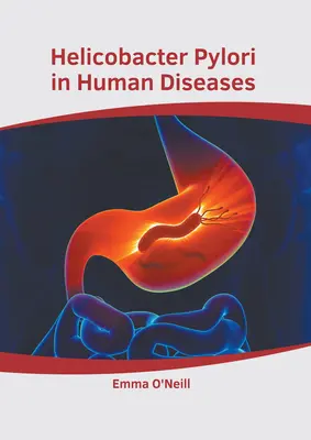 Helicobacter Pylori w chorobach człowieka - Helicobacter Pylori in Human Diseases