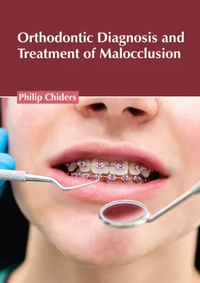 Diagnoza ortodontyczna i leczenie wad zgryzu - Orthodontic Diagnosis and Treatment of Malocclusion