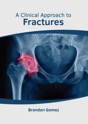 Kliniczne podejście do złamań - A Clinical Approach to Fractures