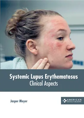 Toczeń rumieniowaty układowy: Aspekty kliniczne - Systemic Lupus Erythematosus: Clinical Aspects