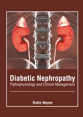 Nefropatia cukrzycowa: Patofizjologia i postępowanie kliniczne - Diabetic Nephropathy: Pathophysiology and Clinical Management