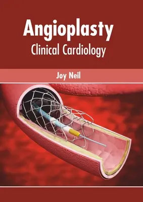 Angioplastyka: Kardiologia kliniczna - Angioplasty: Clinical Cardiology