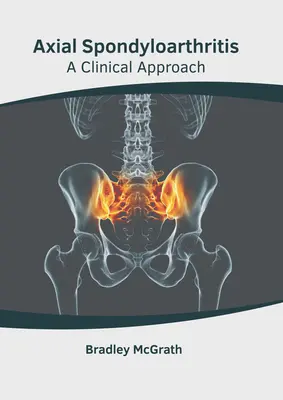 Osiowe zapalenie stawów kręgosłupa: Podejście kliniczne - Axial Spondyloarthritis: A Clinical Approach