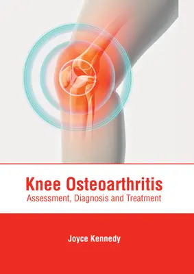 Choroba zwyrodnieniowa stawu kolanowego: Ocena, diagnoza i leczenie - Knee Osteoarthritis: Assessment, Diagnosis and Treatment