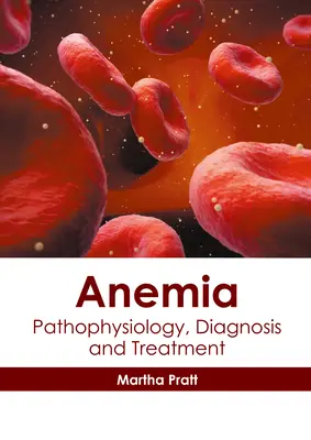 Niedokrwistość: Patofizjologia, diagnostyka i leczenie - Anemia: Pathophysiology, Diagnosis and Treatment