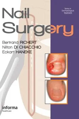 Chirurgia paznokci - Nail Surgery