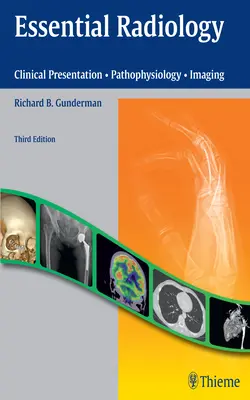 Podstawy radiologii: Prezentacja kliniczna - Patofizjologia - Obrazowanie - Essential Radiology: Clinical Presentation - Pathophysiology - Imaging