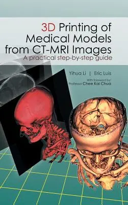 Drukowanie 3D modeli medycznych z obrazów CT-MRI: Praktyczny przewodnik krok po kroku - 3D Printing of Medical Models from CT-MRI Images: A Practical step-by-step guide