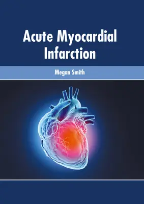 Ostry zawał mięśnia sercowego - Acute Myocardial Infarction