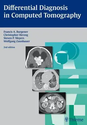 Diagnostyka różnicowa w tomografii komputerowej - Differential Diagnosis in Computed Tomography