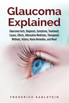 Jaskra wyjaśniona: Jaskra Fakty, Diagnoza, Objawy, Leczenie, Przyczyny, Skutki, Alternatywne Leki, Metody Terapeutyczne, Historia, - Glaucoma Explained: Glaucoma Facts, Diagnosis, Symptoms, Treatment, Causes, Effects, Alternative Medicines, Therapeutic Methods, History,