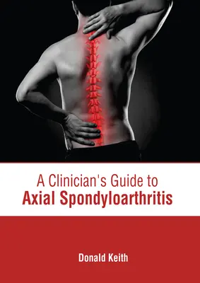 Przewodnik klinicysty po osiowym zapaleniu stawów kręgosłupa - A Clinician's Guide to Axial Spondyloarthritis