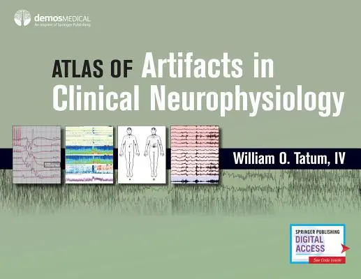 Atlas artefaktów w neurofizjologii klinicznej - Atlas of Artifacts in Clinical Neurophysiology