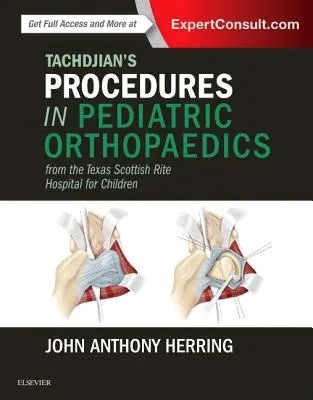 Procedury Tachdjiana w ortopedii dziecięcej: Z teksańskiego szpitala Scottish Rite dla dzieci - Tachdjian's Procedures in Pediatric Orthopaedics: From the Texas Scottish Rite Hospital for Children