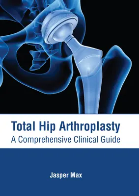 Całkowita endoprotezoplastyka stawu biodrowego: Kompleksowy przewodnik kliniczny - Total Hip Arthroplasty: A Comprehensive Clinical Guide