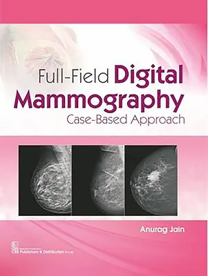 Mammografia cyfrowa pełnego pola: Podejście oparte na przypadkach - Full-Field Digital Mammography: Case-Based Approach