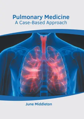 Medycyna płucna: Podejście oparte na przypadkach - Pulmonary Medicine: A Case-Based Approach